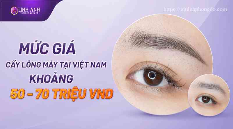 chi phí cấy lông mày - Viện thẩm mỹ quốc tế Linh Anh