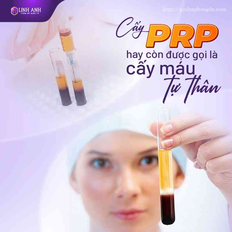 chi phí cấy prp - Viện thẩm mỹ quốc tế Linh Anh