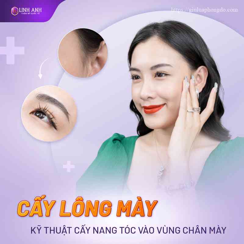 giá cấy lông mày - Viện thẩm mỹ quốc tế Linh Anh